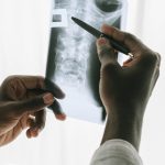 person holding black pen and an x ray